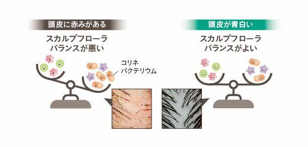 炭酸※1泡のパチパチ感が楽しい頭皮ケア！『クロナ スパークリング ...